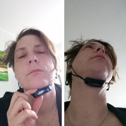 FaceLift™ – Say Goodbye to Double Chin, Hello to Defined Contours