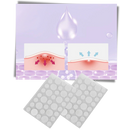 36-Pack Invisible Acne Patches