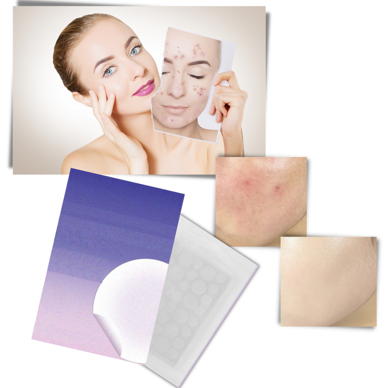 36-Pack Invisible Acne Patches