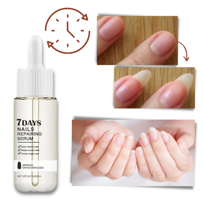 7 Days Nail Repair Essence