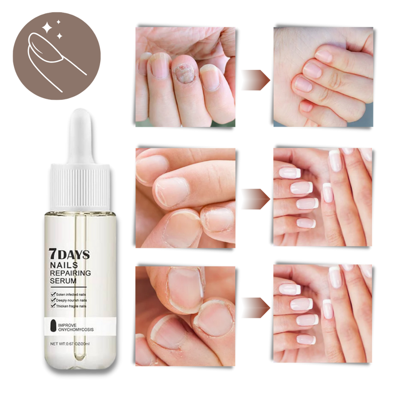 7 Days Nail Repair Essence