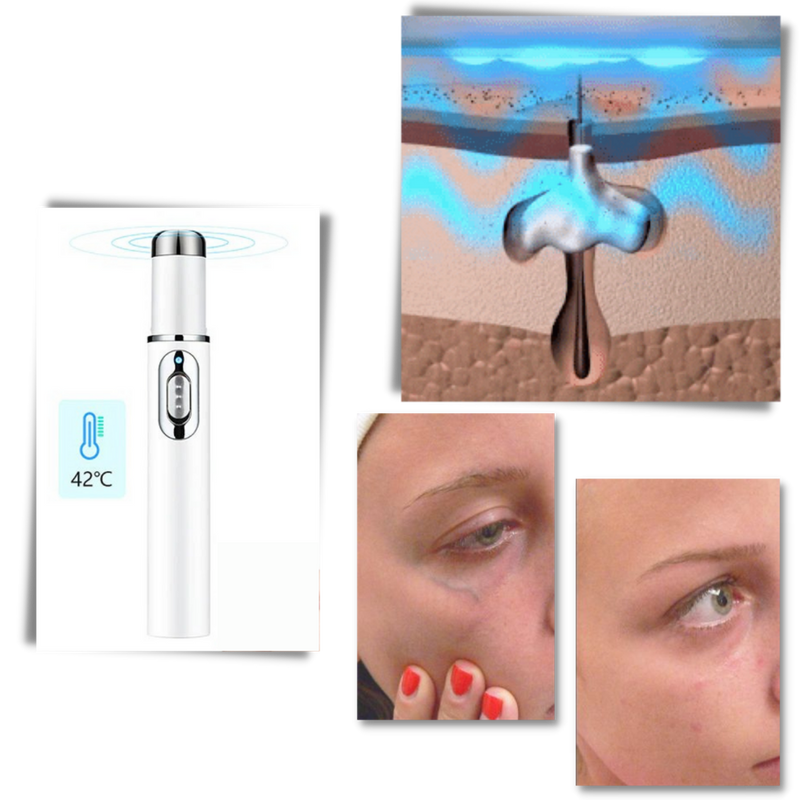 Blue light skin therapy pen