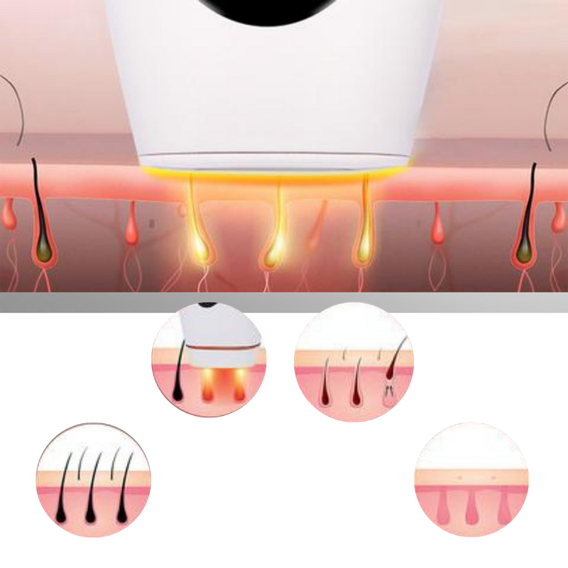 IPL Laser Hair Remover Handset