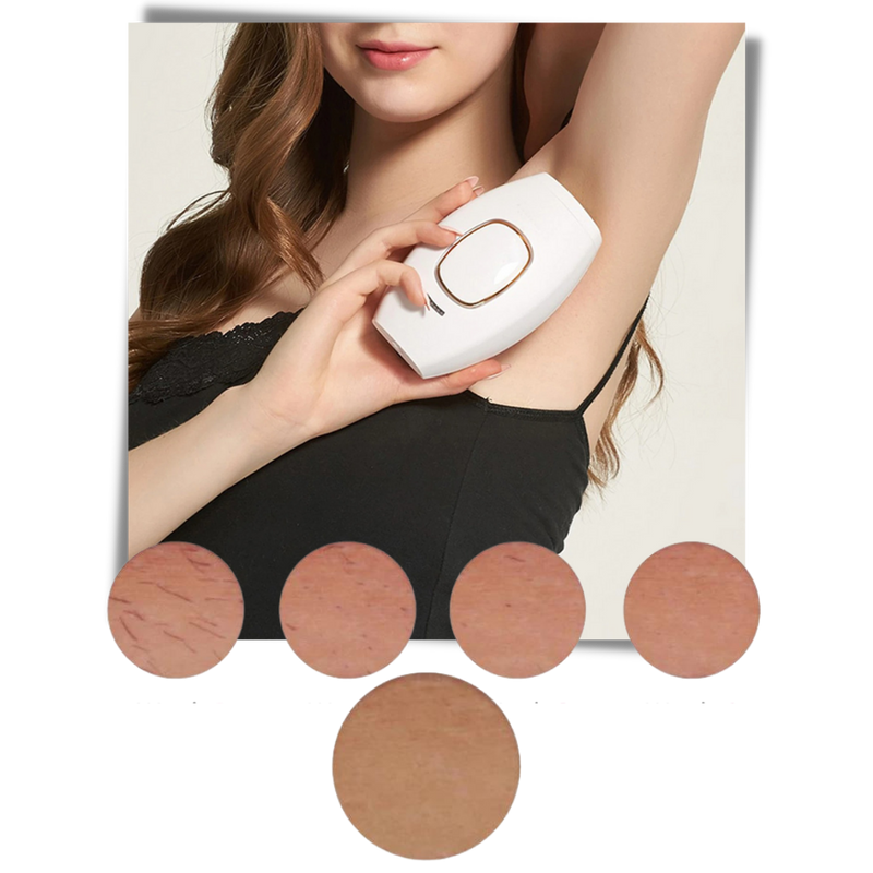 Mini IPL Laser Hair Remover