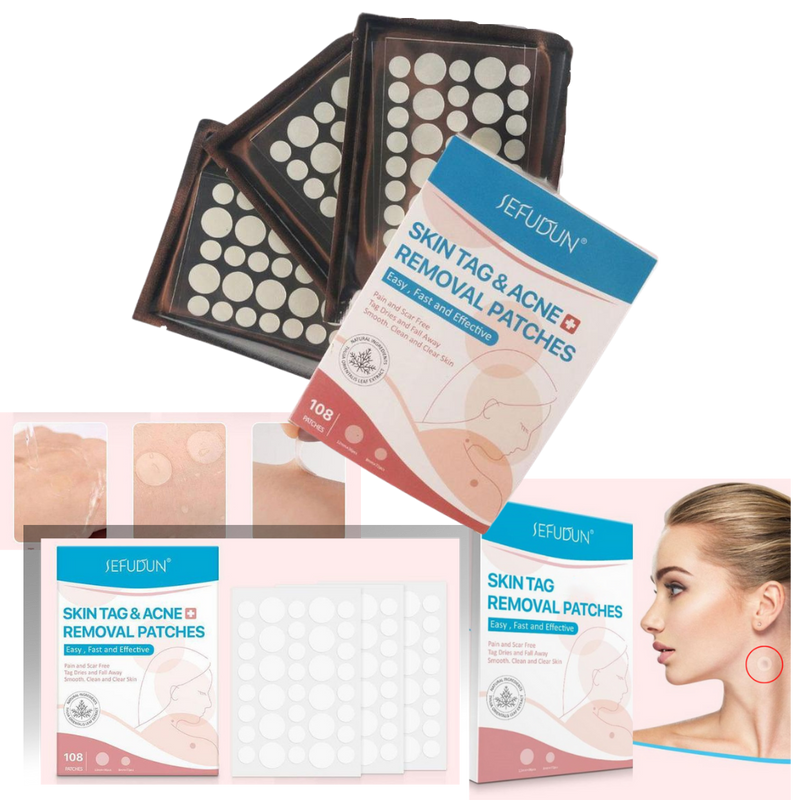Skin tag removal treatment patch