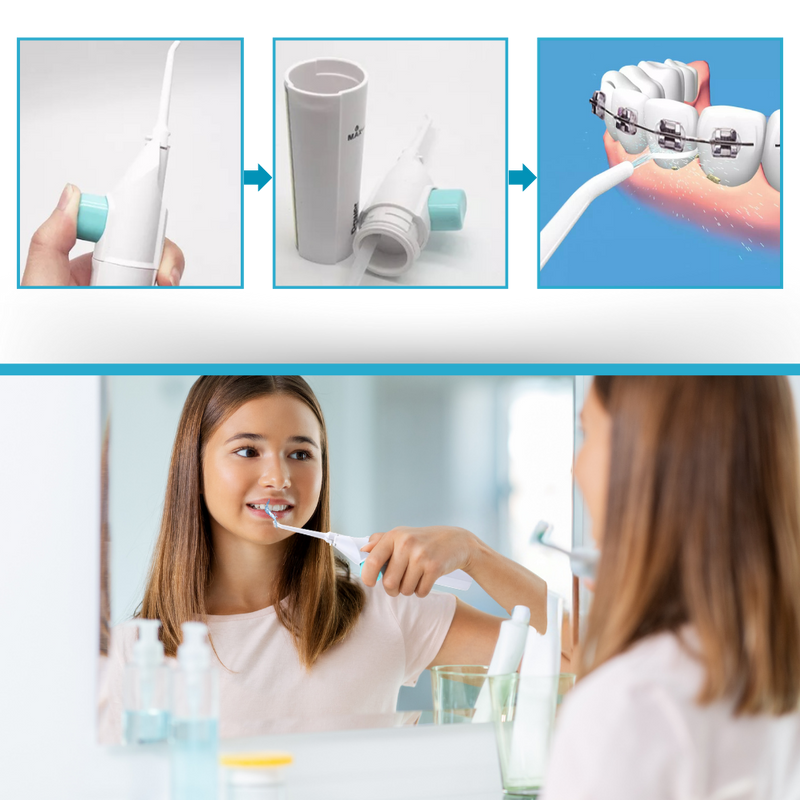 Air Powered Teeth Water Flosser
