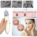 Facial Blackhead Remover Set