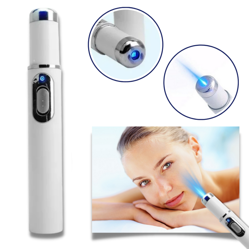 Dark Spot Remover Blue Laser Pen