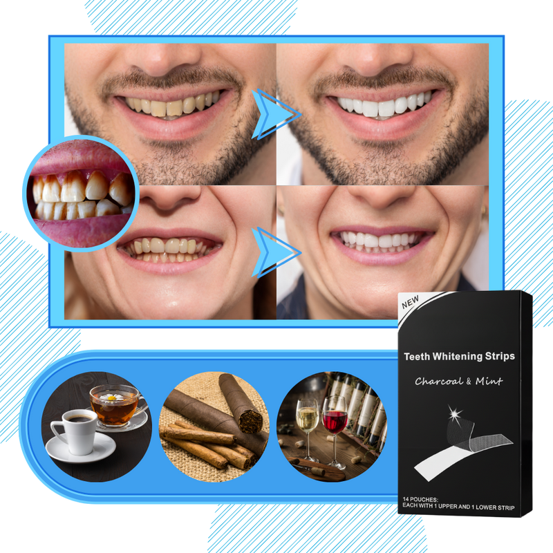 Minty Charcoal Teeth Strips