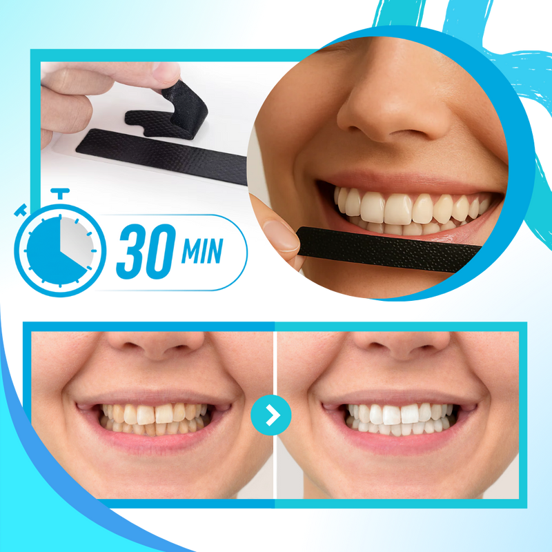 Minty Charcoal Teeth Strips