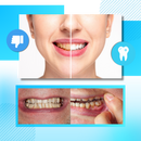 Minty Charcoal Teeth Strips