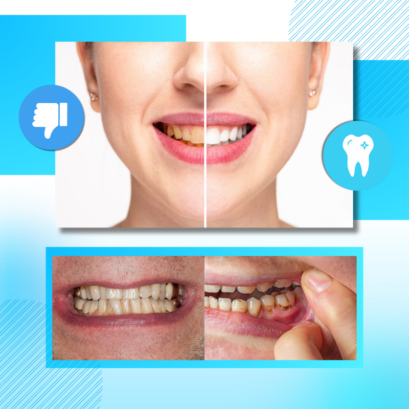 Minty Charcoal Teeth Strips