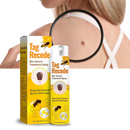 Non-Invasive Tag Recede