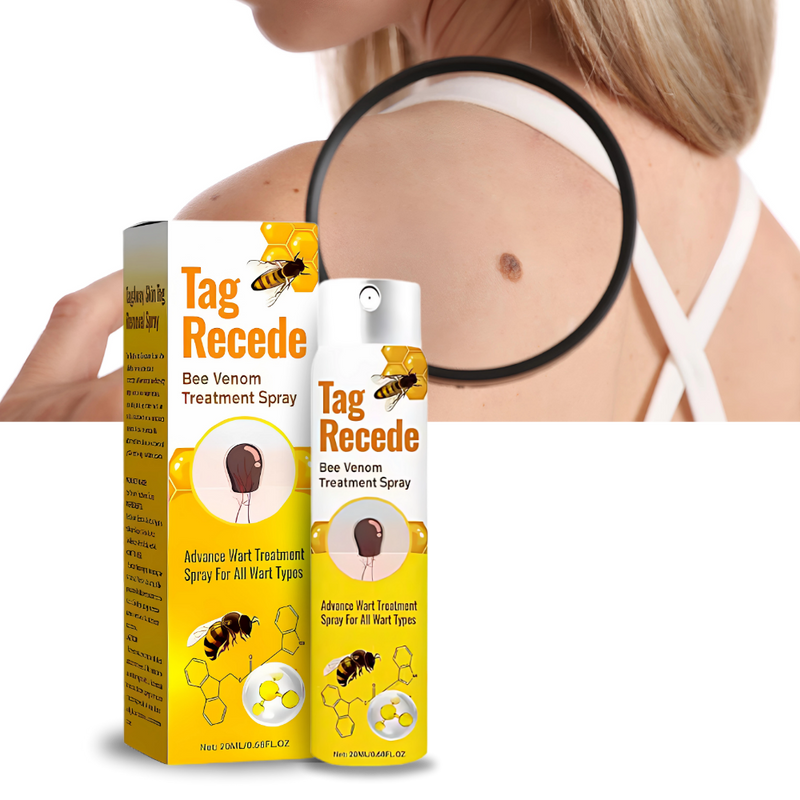 Non-Invasive Tag Recede