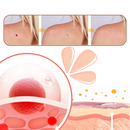 Non-Invasive Tag Recede