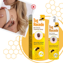 Non-Invasive Tag Recede