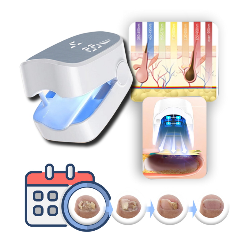 Painless Nail Fungus Laser