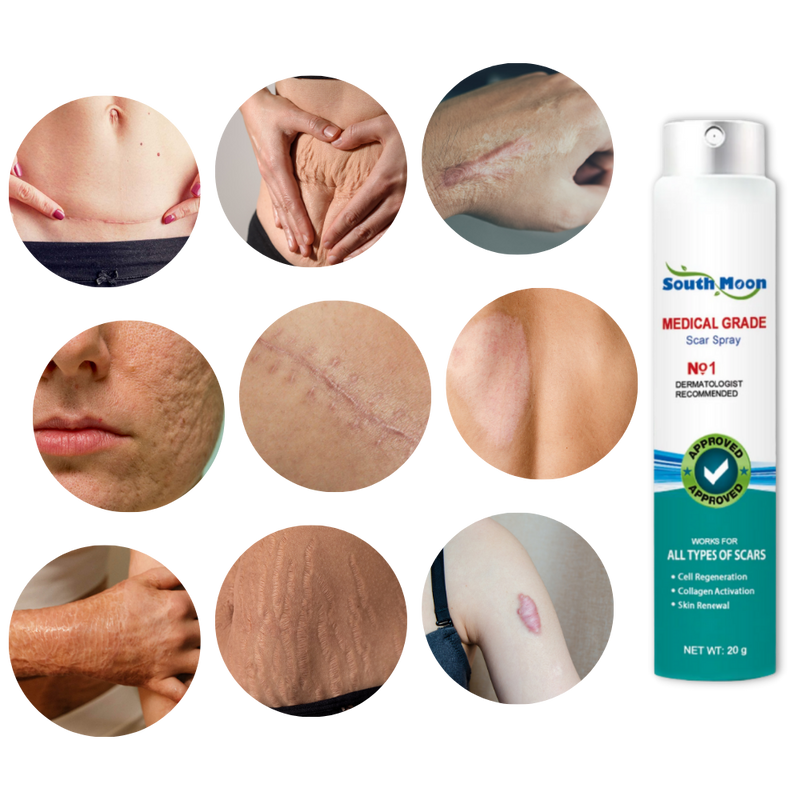 Scar Removal Spray Therapy