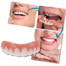 Snap-On Veneer Teeth