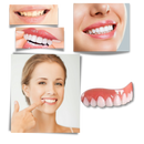 Snap-On Veneer Teeth