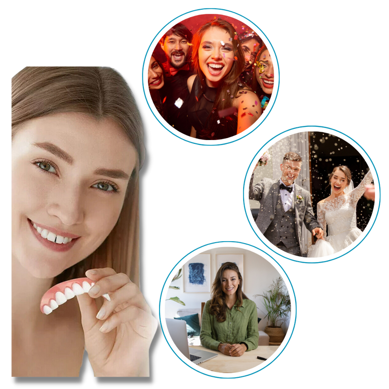 Snap-On Veneer Teeth