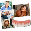 Snap-On Veneer Teeth