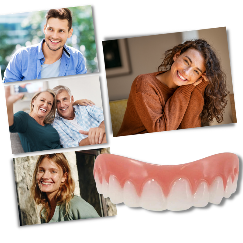 Snap-On Veneer Teeth