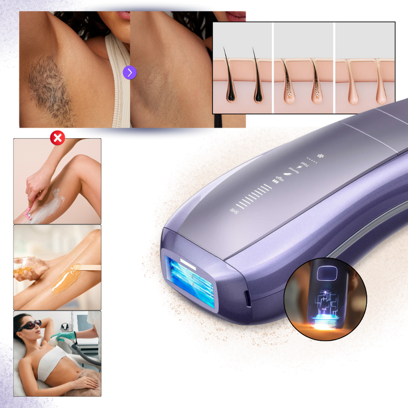 SkinSync Hair Removal Device