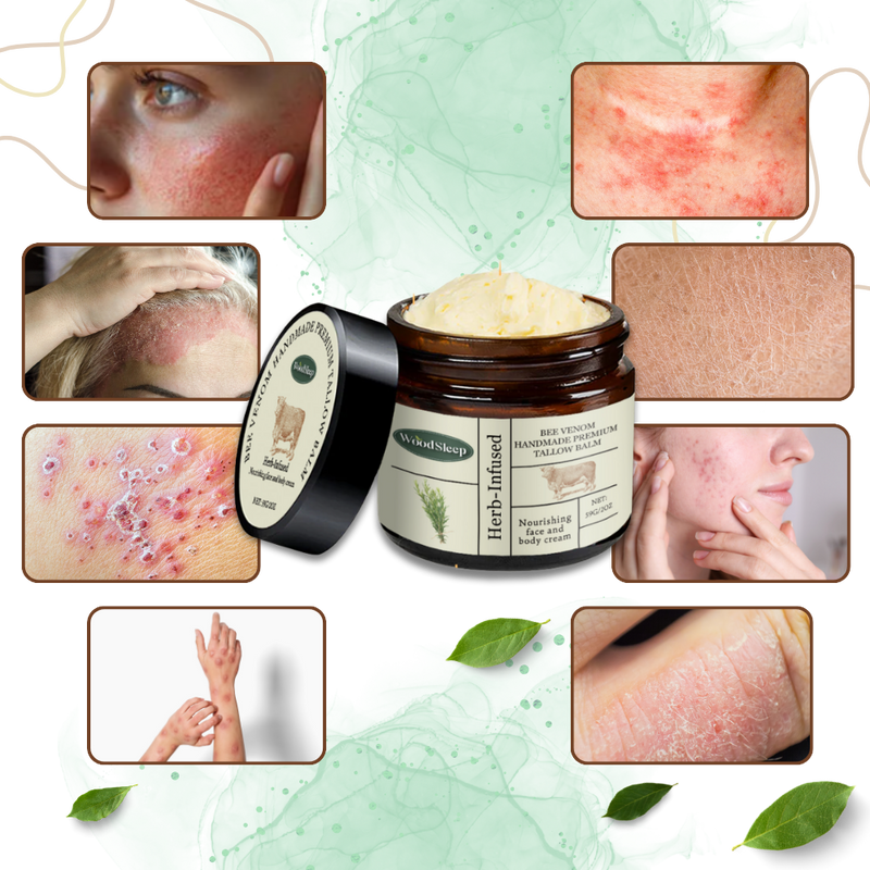 Ultra-Hydrating Bee Venom Cream